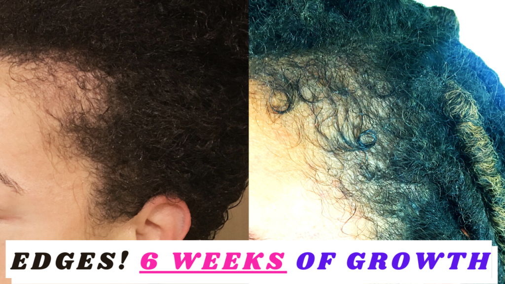 HOW TO GROW YOUR EDGES BACK | 6 Weeks | 3 Items
